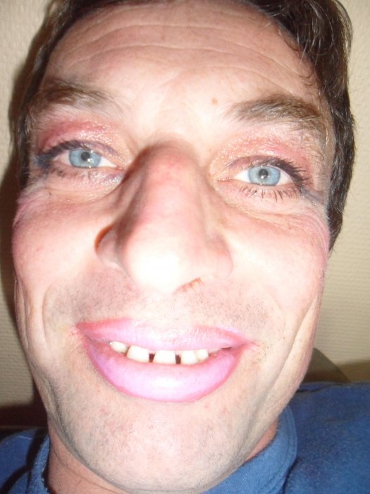 adam zengota (apzengota), dlugosiodlo